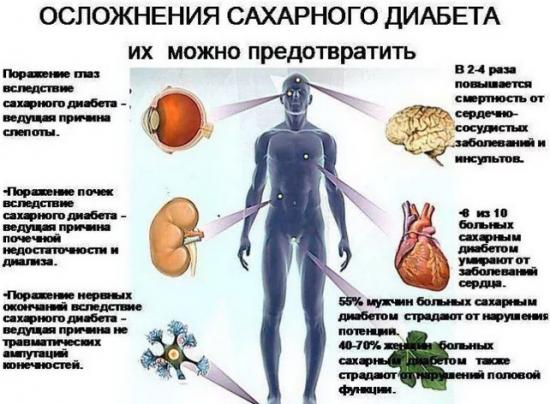 Осложнения сахарного диабета